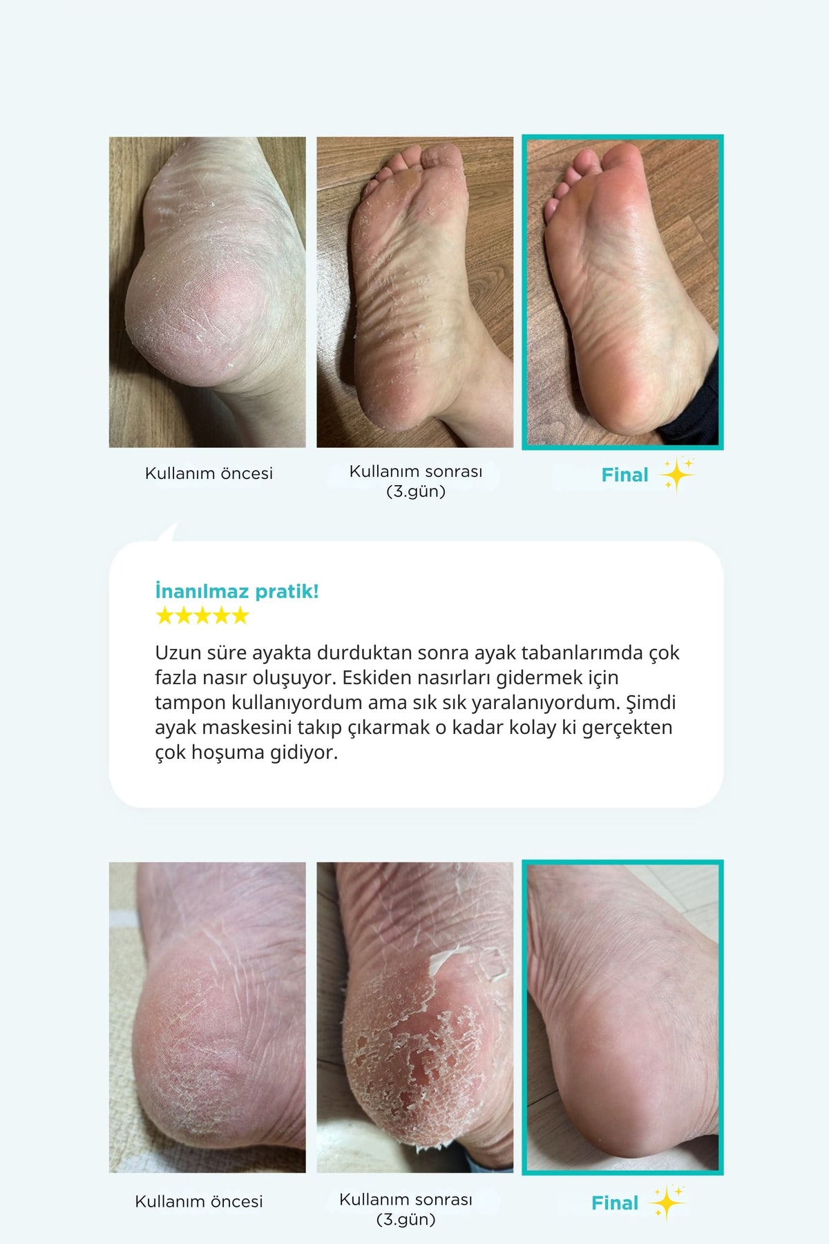 Ariul-Çorap Tipi Ayak Peeling Maskesi 2 Çift-Peeling-6-fleurdirect.live